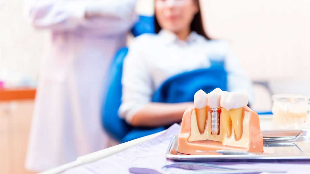 Имплантация зубов в Краснодаре
